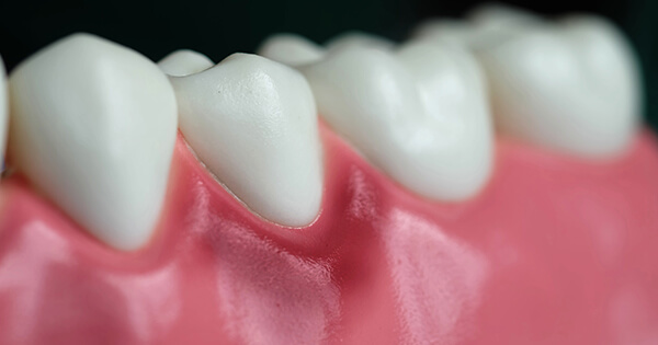 Cauzele sangerarii gingiilor 2